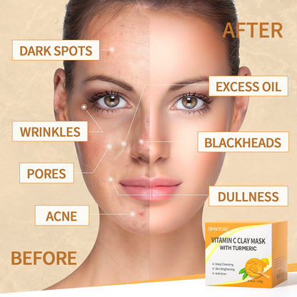 Vitamin C Face Mask with Kaolin Clay and Turmeric for Dark Spots, Dull Skin, Skincare Facial Mask for Controlling Oil and Refining Pores 5.29 Oz - Lines & Co